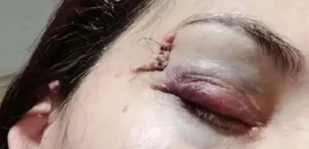 Una docente fue gravemente agredida por un estudiante en un colegio de la zona