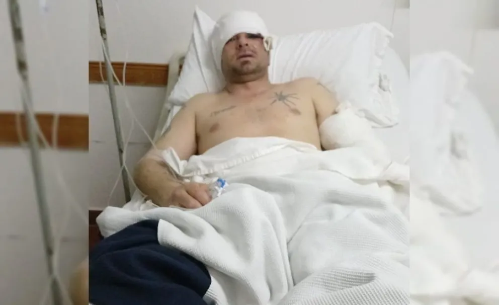 Su hermano recibió una golpiza en Barrio Pompeya y reclama justicia: "Lo podrían haber matado"