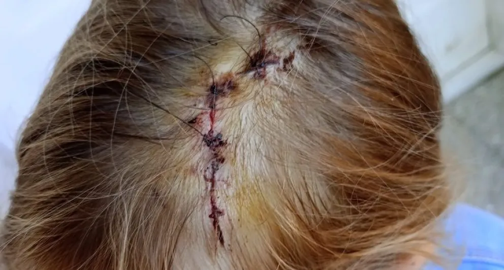 La niña que fue atacada por un perro evoluciona favorablemente: “Esto no puede volver a pasar”