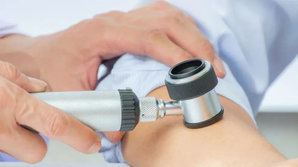 El Hospital de Bolívar se suma a la campaña nacional de prevención del cáncer de piel