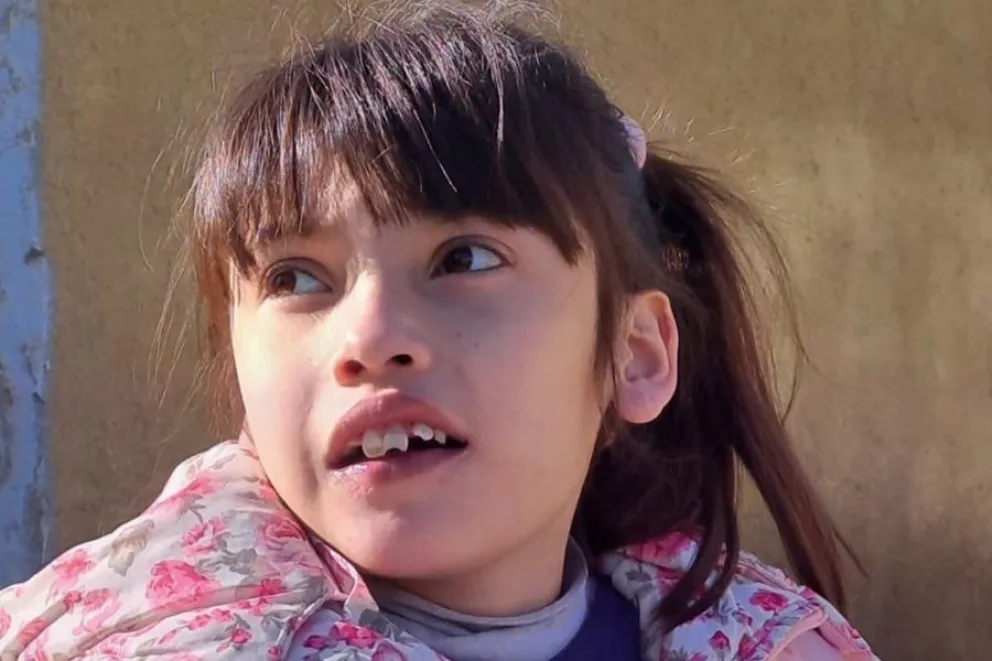 Alma Montrubianesi tiene 11 años y padece una malformación congénita en su corazón.